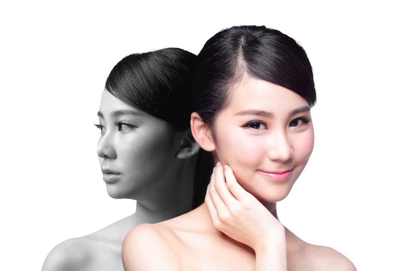 Chăm sóc sau phẫu thuật thẩm mỹ: Chìa khóa vàng cho vẻ đẹp bền lâu